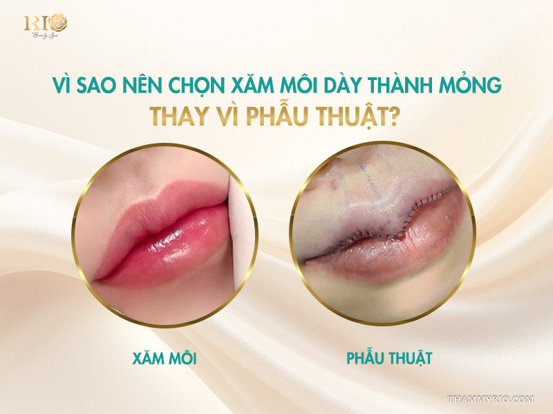  Vì sao nên chọn xăm môi dày thành mỏng thay vì phẫu thuật?