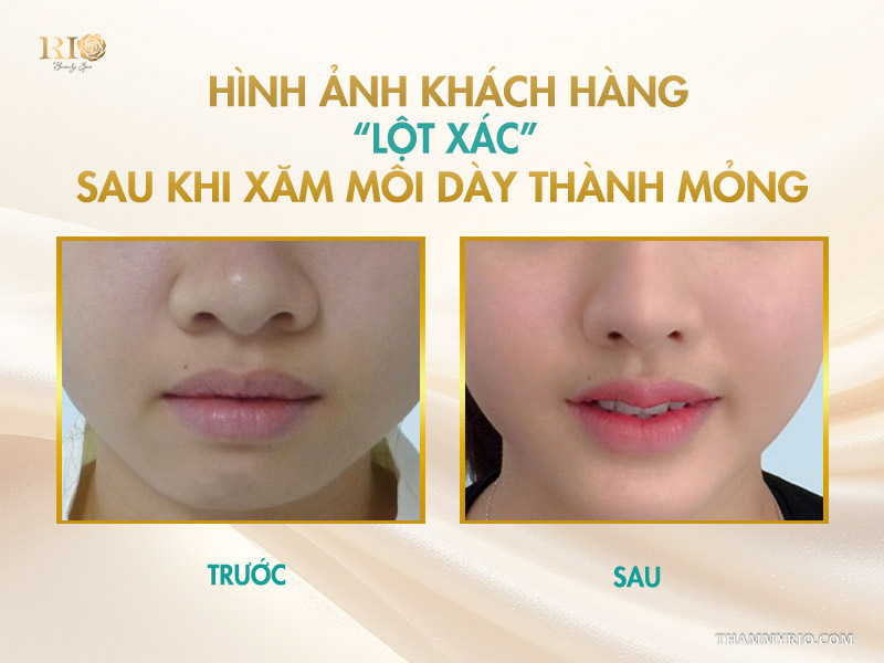 Hình ảnh khách hàng “lột xác” sau khi xăm môi dày thành mỏng