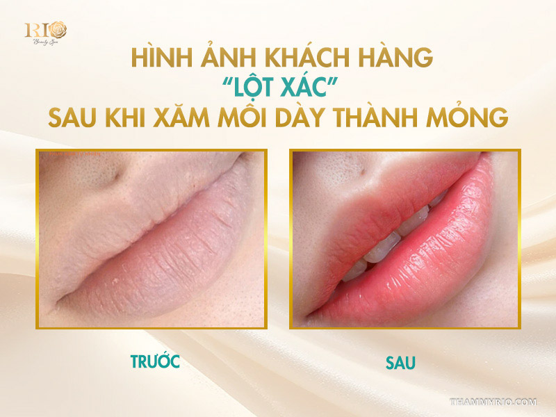 Hình ảnh khách hàng “lột xác” sau khi xăm môi dày thành mỏng
