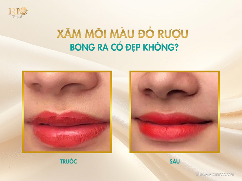 Xăm môi màu đỏ rượu bong ra có đẹp không?