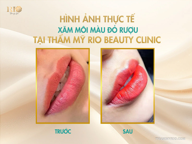 Hình ảnh thực tế xăm môi màu đỏ rượu tại Thẩm mỹ Rio