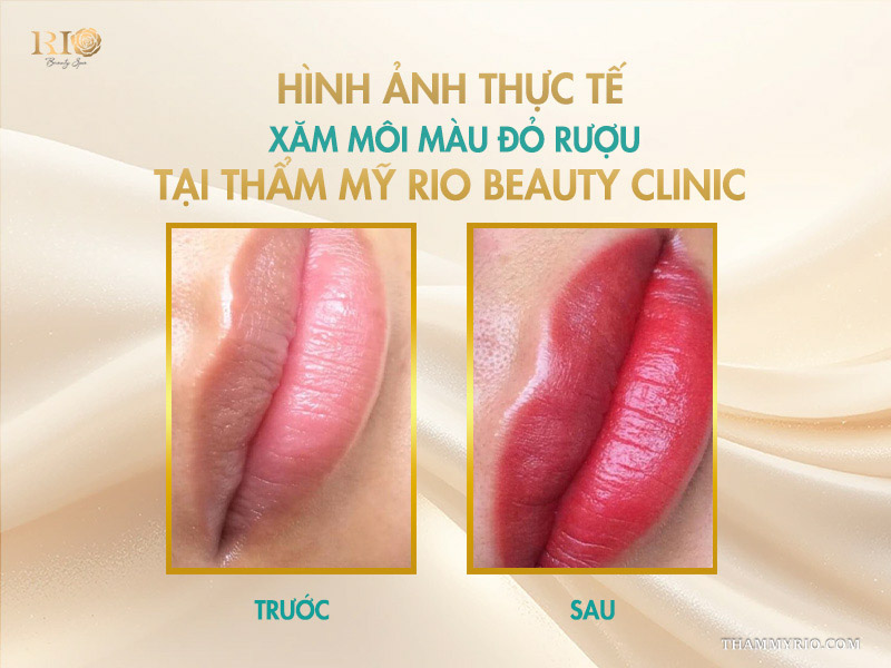 Hình ảnh thực tế xăm môi màu đỏ rượu tại Thẩm mỹ Rio