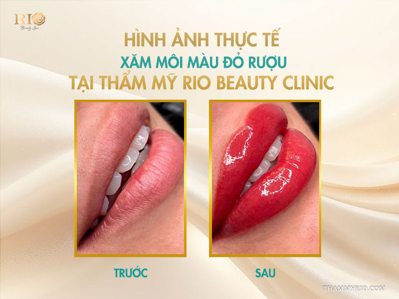 Hình ảnh thực tế xăm môi màu đỏ rượu tại Thẩm mỹ Rio