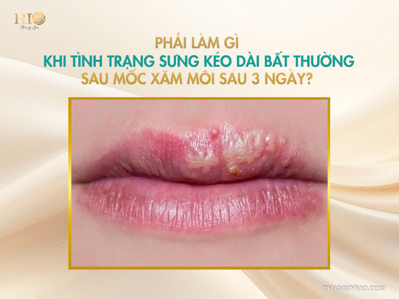 Phải làm gì khi tình trạng sưng kéo dài bất thường sau mốc xăm môi sau 3 ngày?