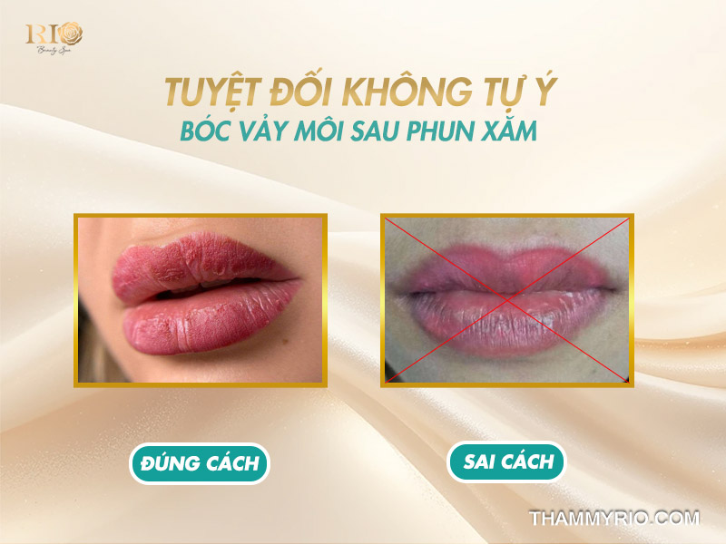 Phun xăm môi mấy ngày thì bôi dưỡng để môi nhanh bong đẹp? 6 Tuyệt đối không tự ý bóc môi sau khi phun vì dễ gây loang màu và nhiễm trùng.