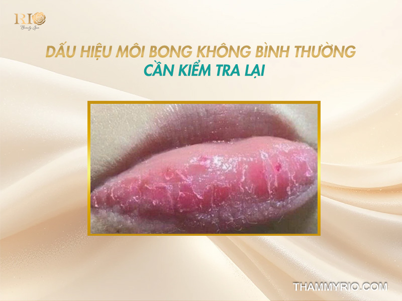 Phun xăm môi mấy ngày thì bôi dưỡng để môi nhanh bong đẹp? 7 Dấu hiệu môi bong bất thường cần kiểm tra lại, thời gian xâm môi mấy ngày tróc trung bình 3-7 ngày