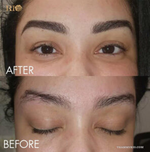 Before and after comparison of 3d microblading results showing natural hair-like strokes for thin eyebrows.