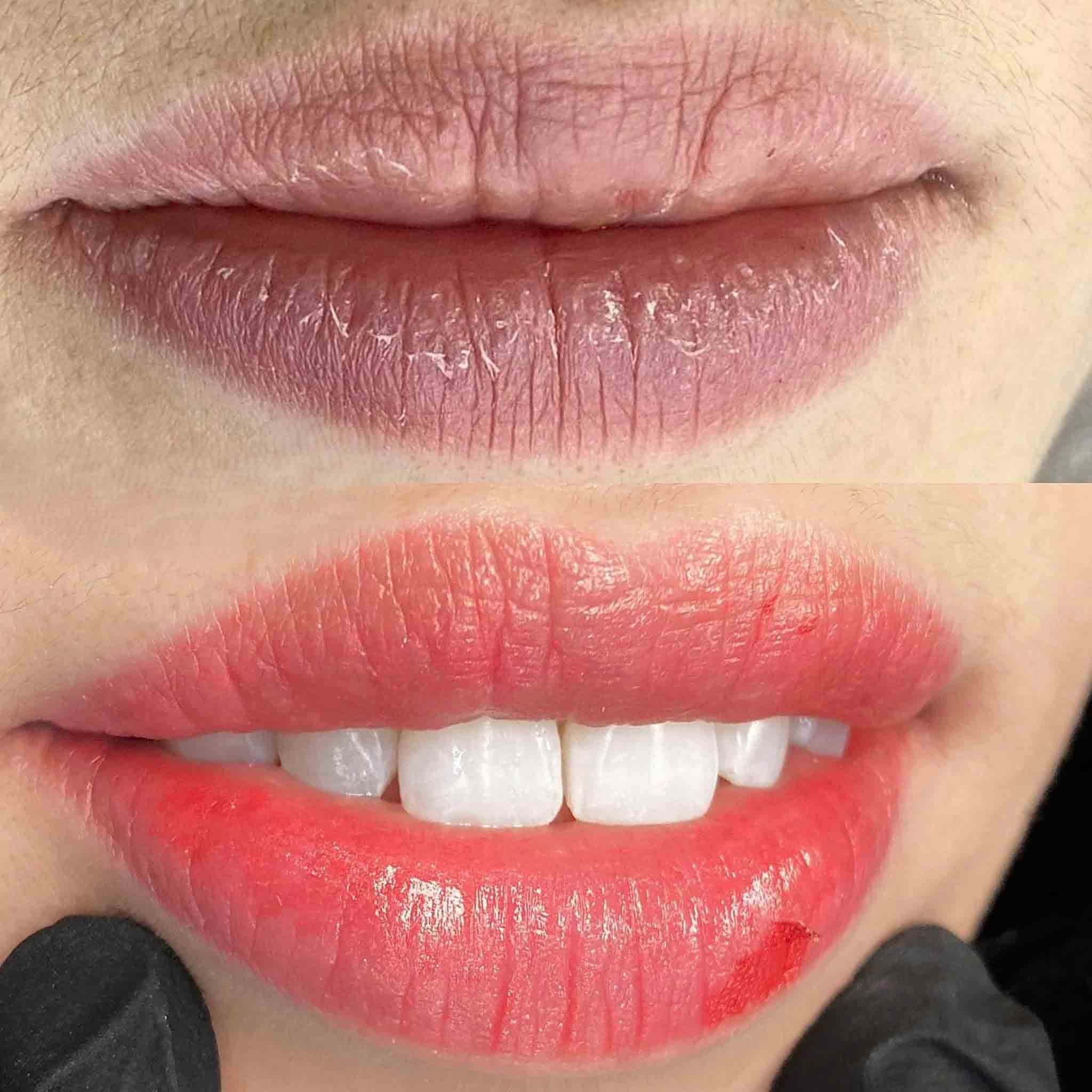 Award-Winning Lip PMU and Dark Lip Correction masterpiece that clinched a major prize at a prestigious Korean aesthetic competition