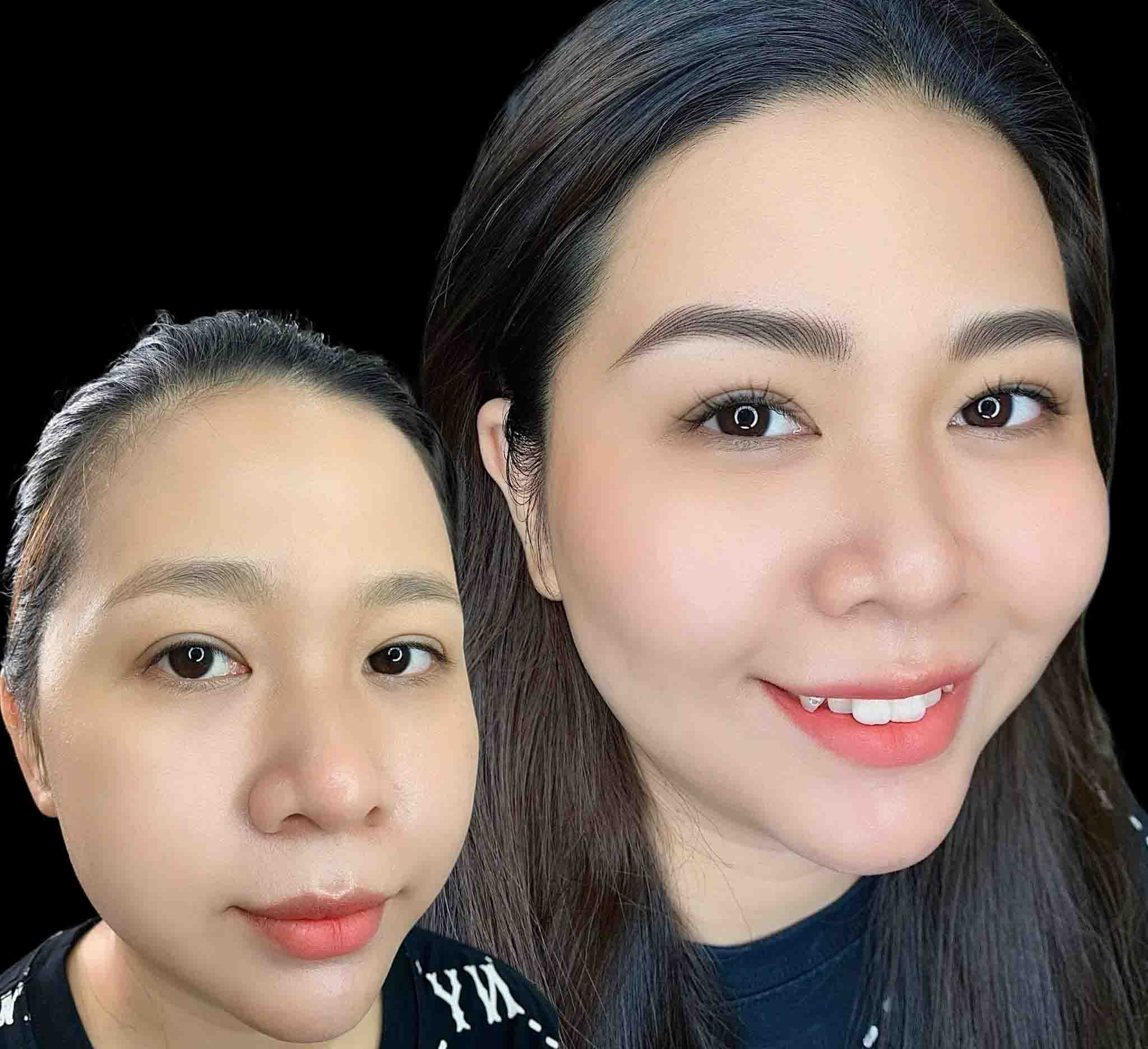 Before and After natural Hairstroke eyebrows result by Rio Beauty Clinic Master Artist