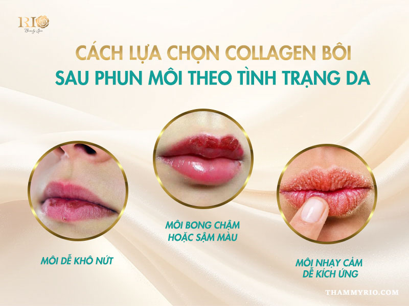 Có nên dùng collagen dưỡng môi sau xăm không? Tác dụng là gì? 4 Giá collagen dưỡng môi sau xăm và cách chọn theo tình trạng da