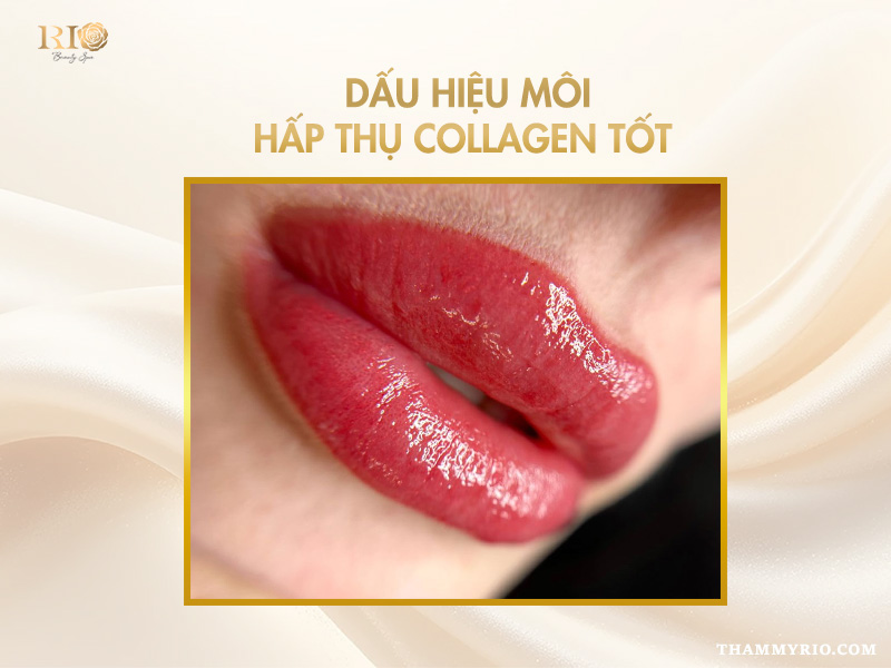 Có nên dùng collagen dưỡng môi sau xăm không? Tác dụng là gì? 5 collagen dưỡng môi sau xăm và dấu hiệu môi hấp thụ tốt