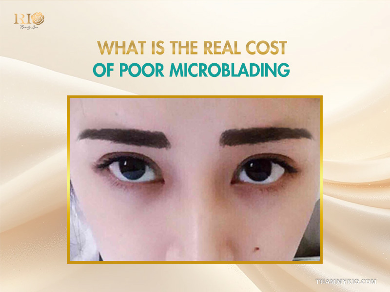 A woman with unnatural, thick, and blocky eyebrows illustrating the hidden cost microblading mistakes can have on your appearance.