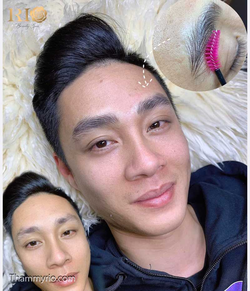 dieu khac long may hairstroke tham my rio beauty clinic 30 of 148