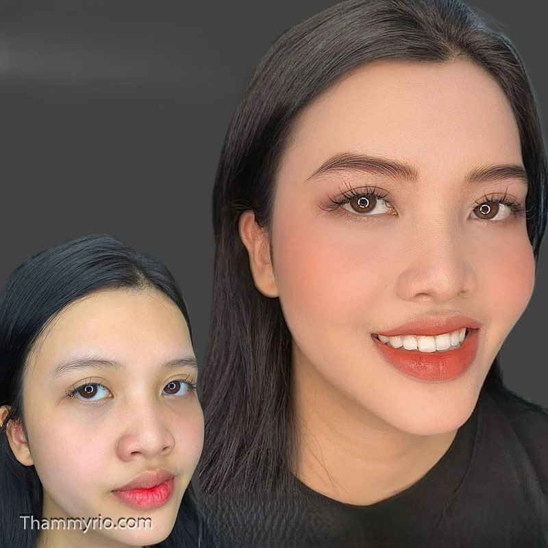 dieu khac long may hairstroke tham my rio beauty clinic 66 of 148