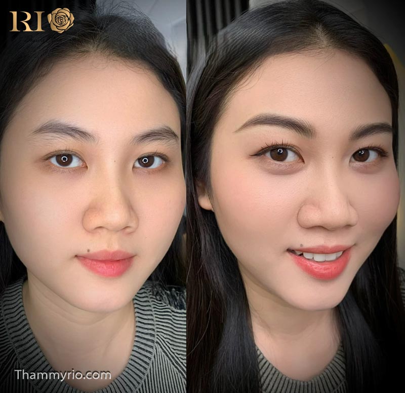 dieu khac long may hairstroke tham my rio beauty clinic 73 of 148