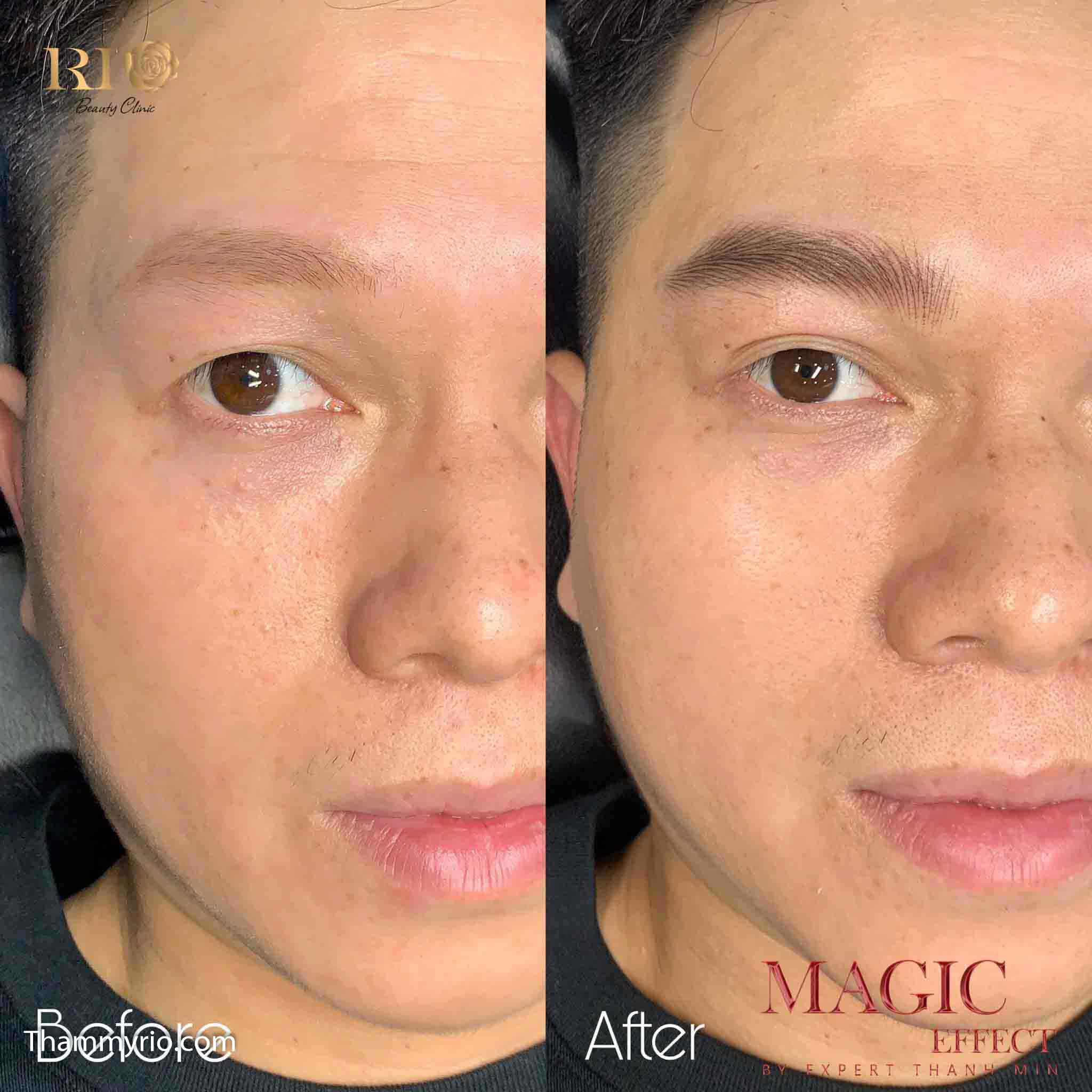 Artist Master Mely Thao: The Global PMU Educator and Master Artisan 9 Artist Master Mely Thao performing Male Hairstroke Eyebrow PMU for a natural and defined men's brow