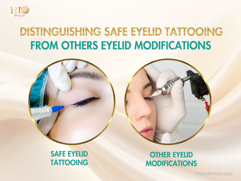 Eyelid Tattooing: Safe Technique, Cost, Pain, And Results 3 Distinguishing safe eyelid tattooing from other eyelid modifications