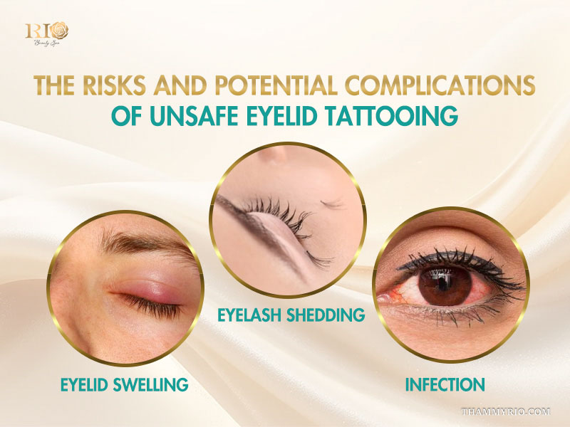 Eyelid Tattooing: Safe Technique, Cost, Pain, And Results 5 Why do international tourists choose Rio Beauty Clinic for eyelid tattooing?
