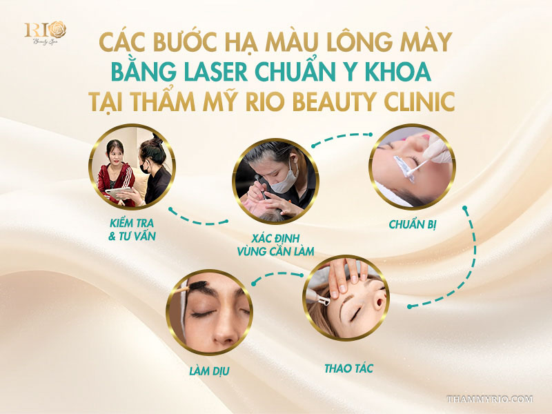 Các bước hạ màu lông mày bằng laser chuẩn y khoa tại Thẩm mỹ Rio Beauty Clinic