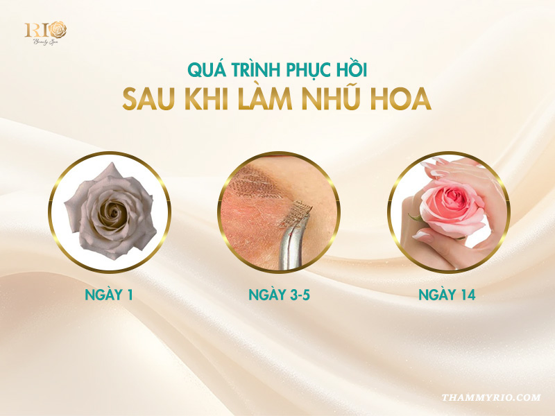 Quá trình phục hồi sau khi làm hồng nhũ hoa spa