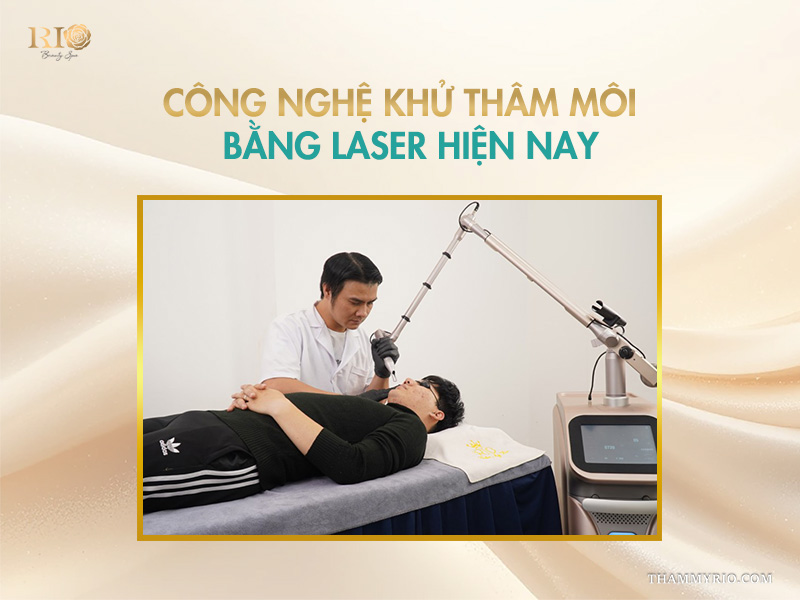 Cách khắc phục môi thâm nâu hiệu quả nhất 2026 7 Công nghệ khử thâm môi bằng laser hiện nay.