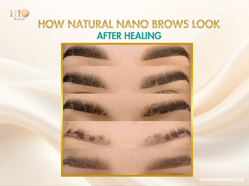 Nano brows: Get natural hair-stroke brows without pain 5 How natural nano brows look after healing