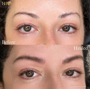 Real before and after results of a permanent brow treatment showcasing natural hair-like strokes.