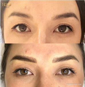 Real before and after results of a permanent brow treatment showcasing natural hair-like strokes.
