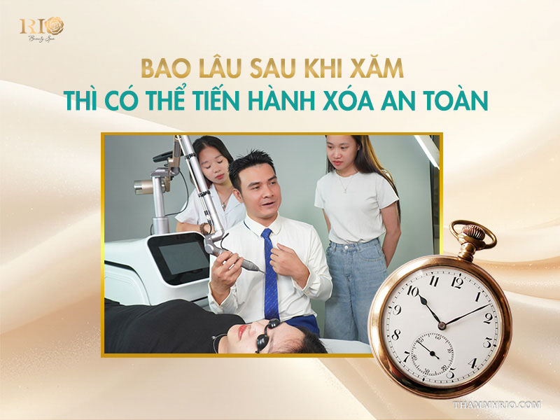 4 Vừa xăm xong có xoá được không? Thời gian an toàn