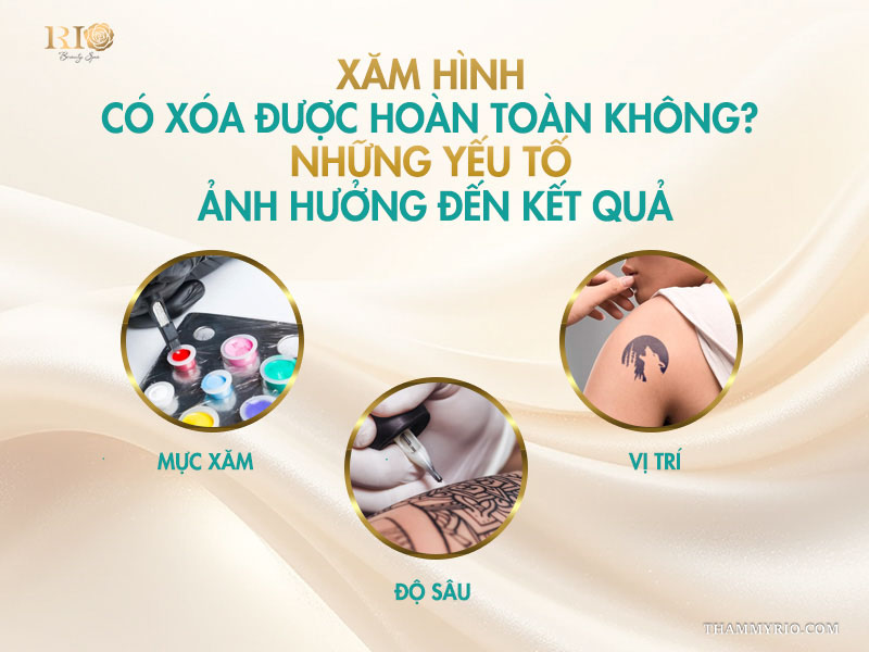 5 4 yếu tố quyết định xoá xăm có hết sạch được không: Mực, độ sâu, vị trí và tuổi xăm