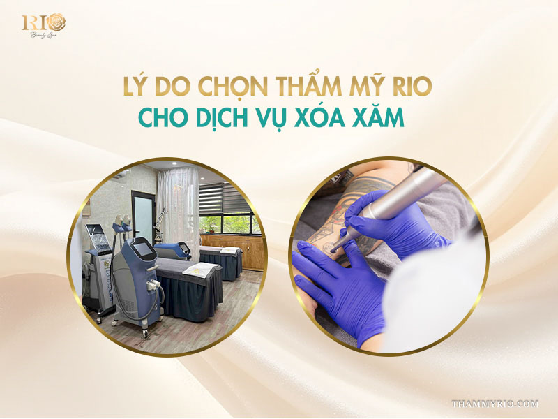 8 Lý do chọn Thẩm Mỹ Rio cho dịch vụ xoá xăm