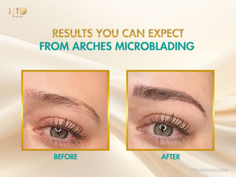 Real results of arches microblading treatment showing before and after eyebrow enhancement.