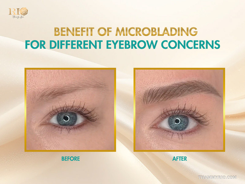 Before and after comparison showcasing the benefit of microblading for different eyebrow concerns like thinness or gaps.