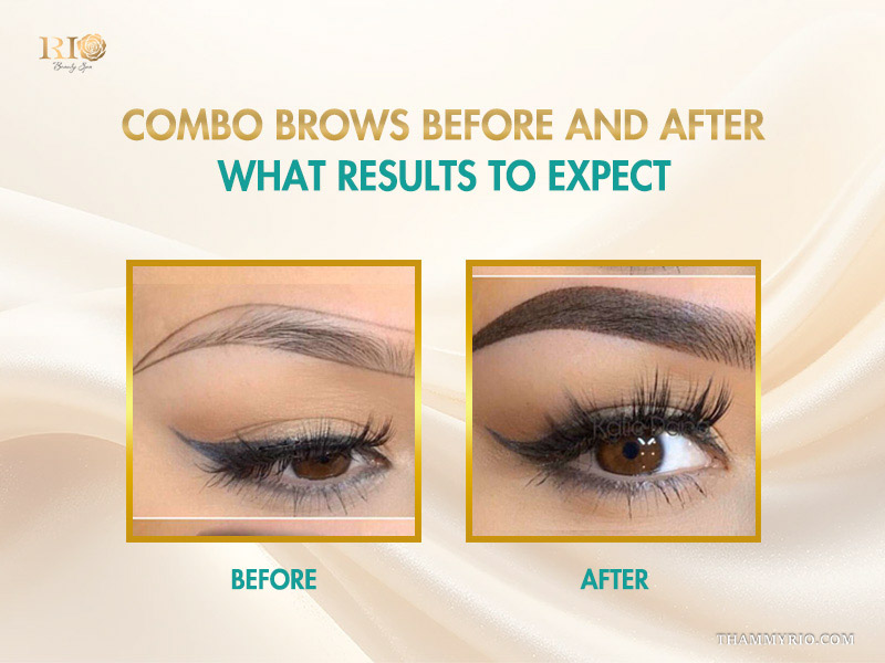 Before and after transformation results of the combo brows technique.