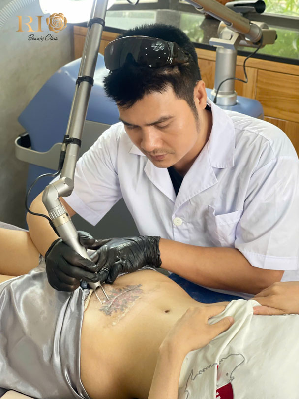 Thẩm Mỹ Rio Beauty Clinic là địa chỉ xóa hình xăm uy tín với công nghệ laser hiện đại