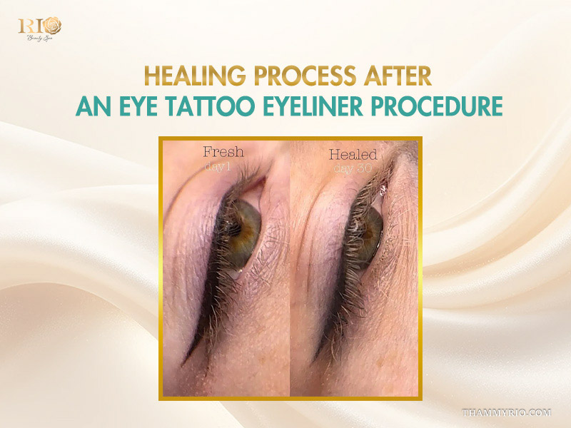 Side view comparison of eye tattoo eyeliner healing process from day 1 to day 30.