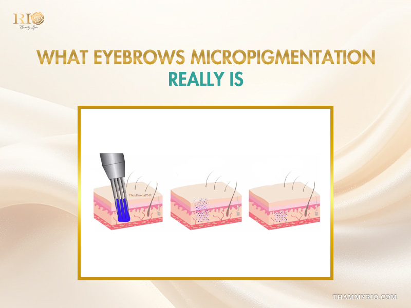 Diagram illustrating the technical process of eyebrows micropigmentation showing pigment being deposited into the skin layers.