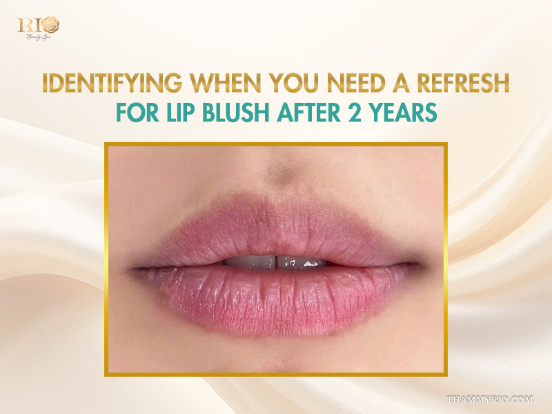 Faded lip pigment indicating the need for a touch-up of lip blush after 2 years.