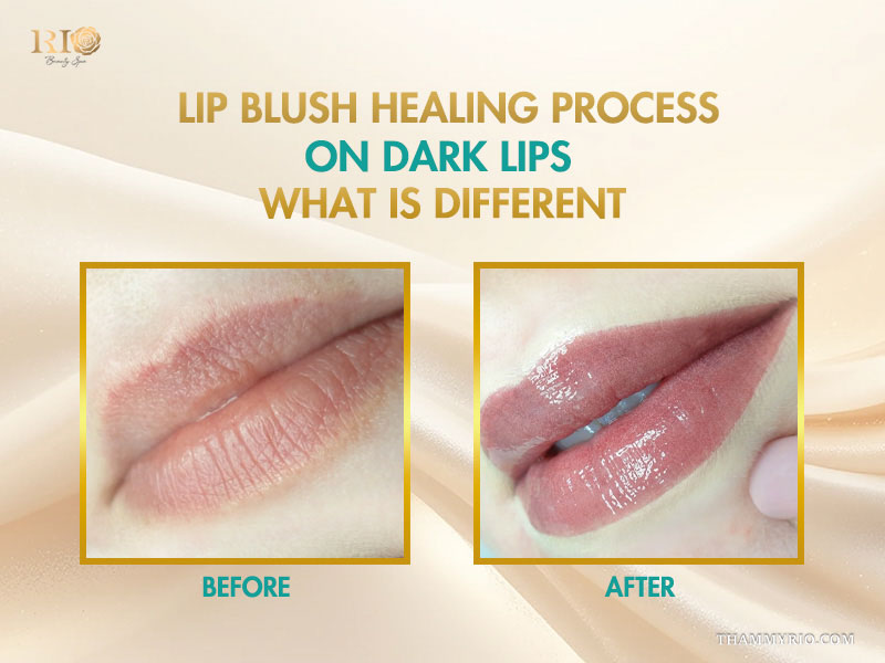Lip blush healing process on dark lips before and after comparison.