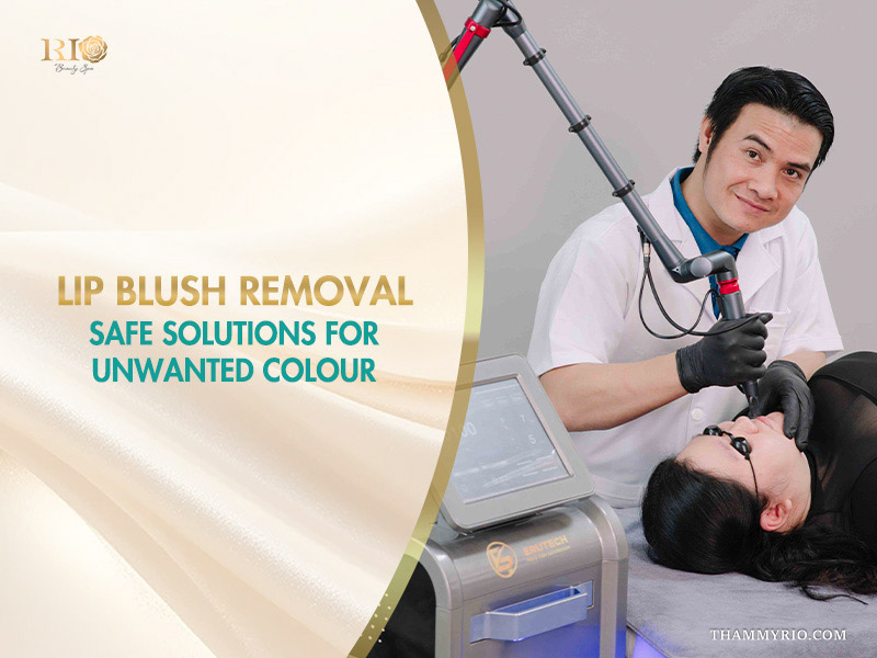 Professional lip blush removal procedure using advanced laser technology at Rio Beauty Spa.