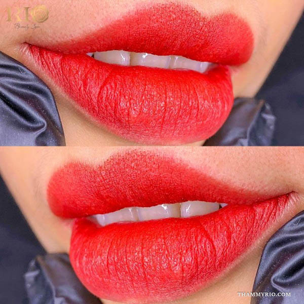 Vibrant red results of lip micro pigmentation providing a bold and defined look.