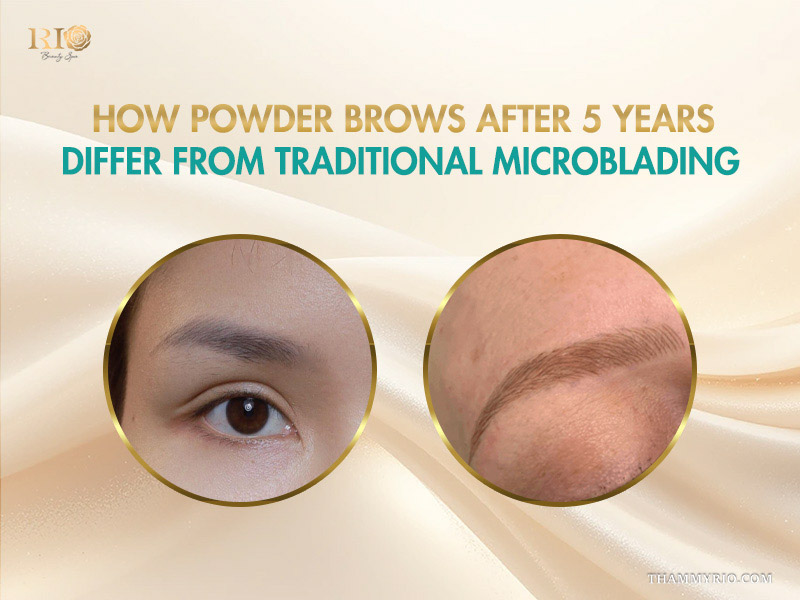 Comparison between powder brows and traditional microblading after 5 years for longevity.