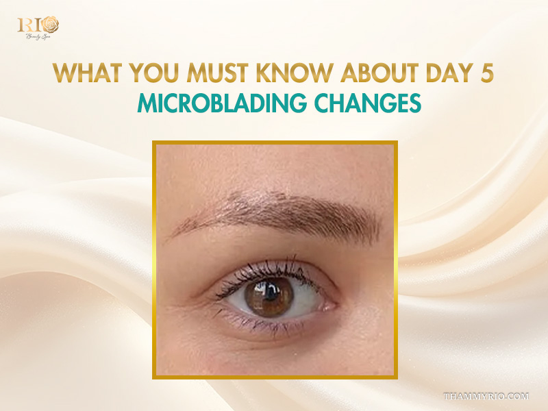 Microblading days day 5 showing scabbing and peeling process on eyebrows.