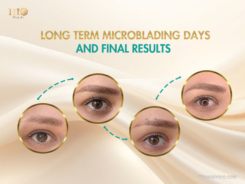 Comparison of eyebrow appearance through long term microblading days and final results.