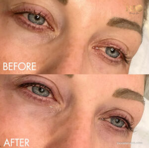 Before and after microblading eye liner transformation showing a natural lash line enhancement for light-colored eyes.