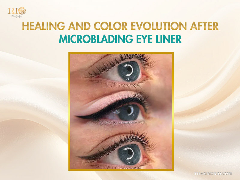 Healing process and color evolution of the eyelid after a microblading eye liner procedure.