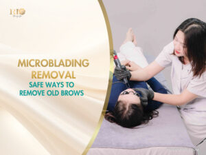 Professional laser microblading removal procedure at Rio Beauty Spa to clear old eyebrow tattoos.