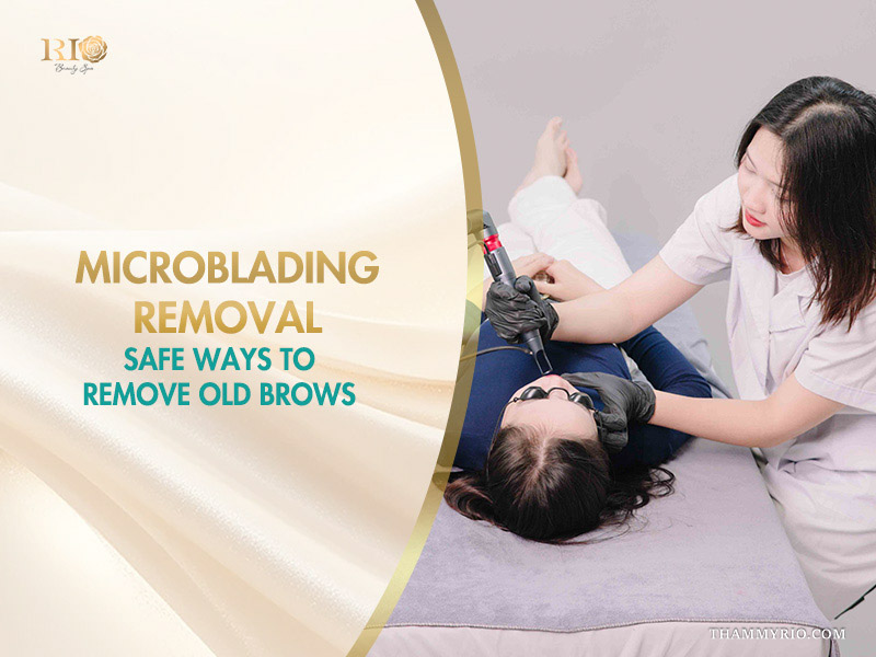Professional laser microblading removal procedure at Rio Beauty Spa to clear old eyebrow tattoos.