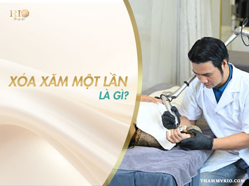 Hình ảnh xóa hình xăm 1 lần tại Thẩm Mỹ Rio Beauty Clinic bằng công nghệ hiện đại cho khách hàng cần xử lý gấp