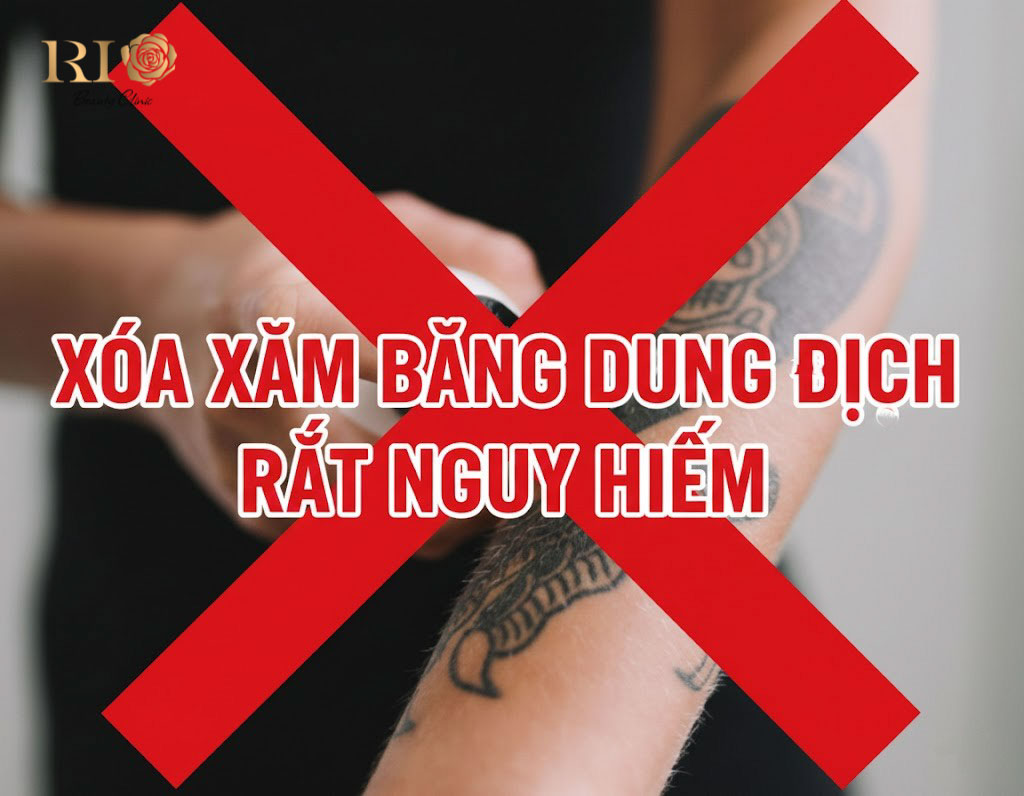 Cảnh báo nguy hiểm khi xóa xăm bằng dung dịch trôi nổi với dấu gạch chéo đỏ và dòng chữ cảnh báo tại Rio Beauty Clinic.